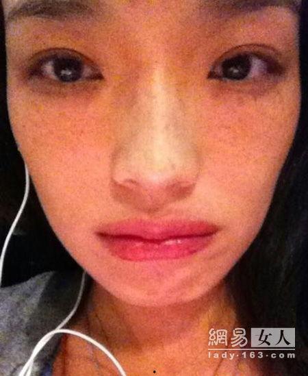 雀斑明星,独特魅力下的美丽传奇